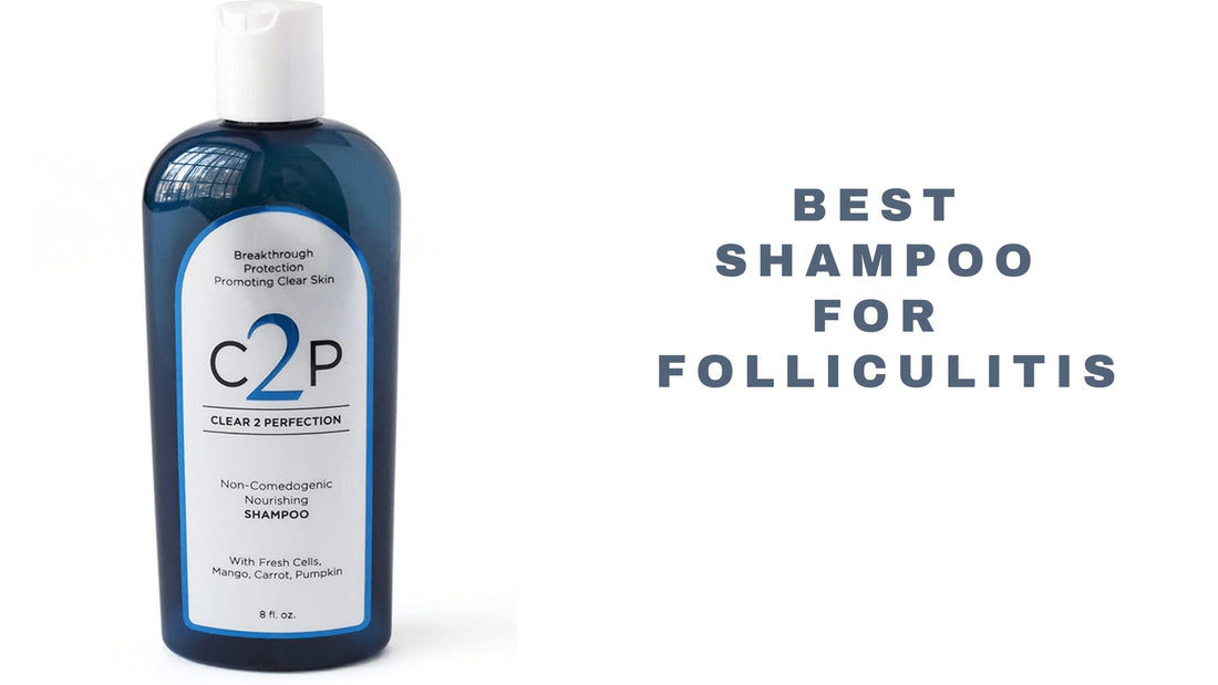 12 Best Shampoo For Folliculitis 2025