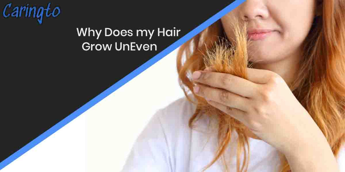 Why Does my Hair Grow UnEven||Hairs and Their Myths