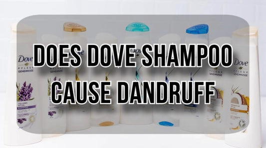 does-dove-shampoo-cause-dandruff