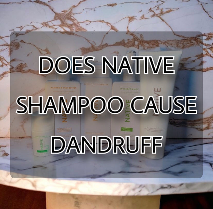 does-native-shampoo-cause-dandruff